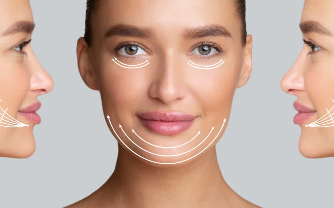 Fadenlifting in München