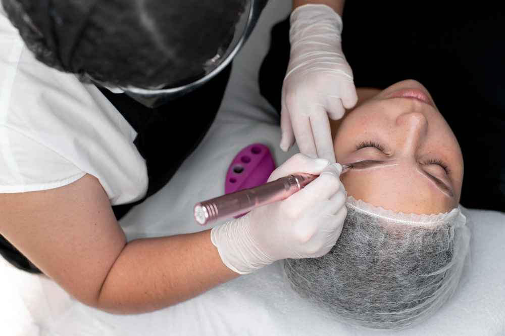 Microneedling in München