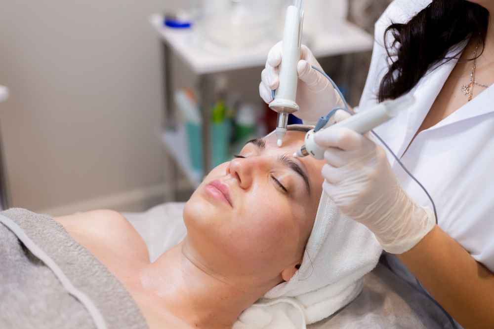 Microneedling in München