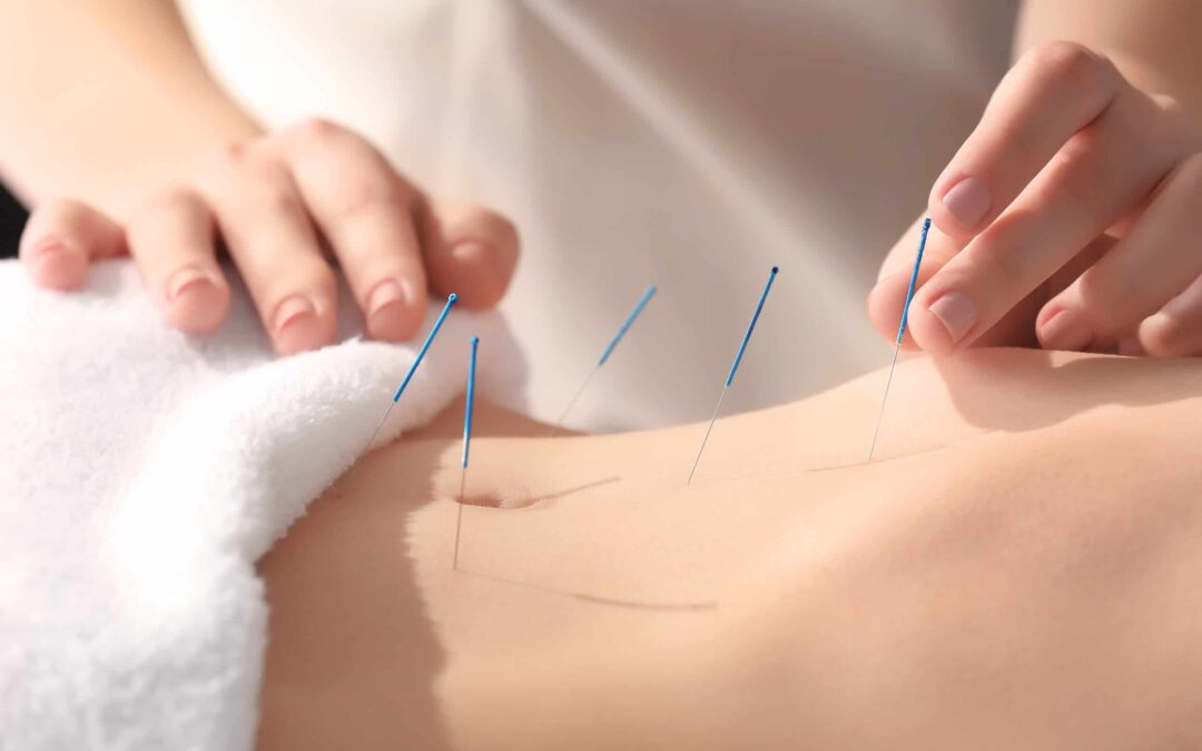 Therapie in München – Traditionelle Chinesische Medizin, Akupunktur & ganzheitliche Heilmethoden
